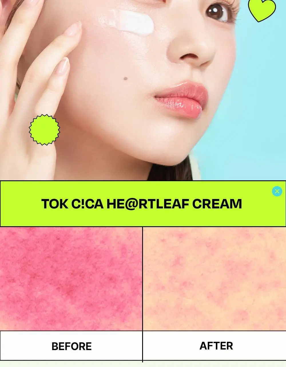 [붉은피부진정/속보습] 에딧비 진정 톡 시카 어성초 크림 100ml 상세페이지 11